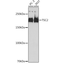 TSC2 Rabbit mAb