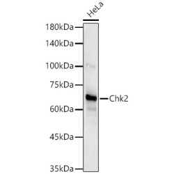 Chk2 Rabbit mAb