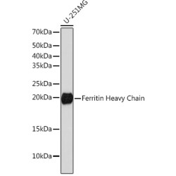 Ferritin Heavy Chain Rabbit mAb