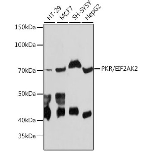 PKR/EIF2AK2 Rabbit mAb