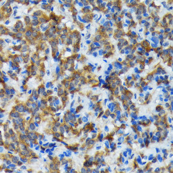 Thyroid Peroxidase Rabbit mAb