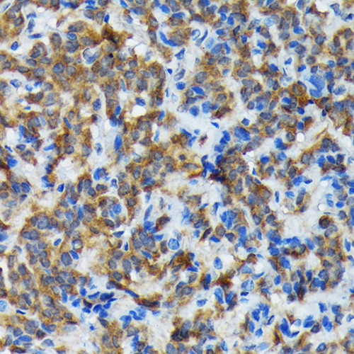 Thyroid Peroxidase Rabbit mAb