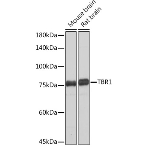 TBR1 Rabbit mAb