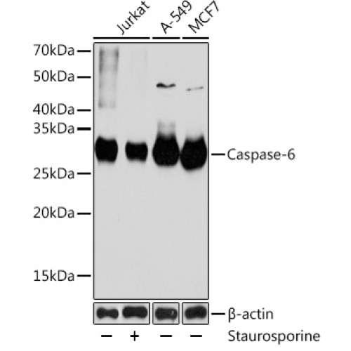 Caspase-6 Rabbit mAb