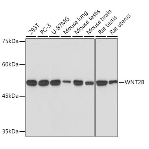 WNT2B Rabbit mAb