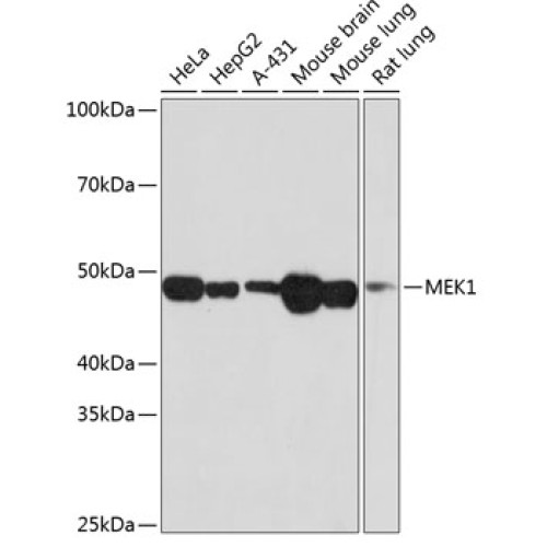 MEK1 Rabbit mAb