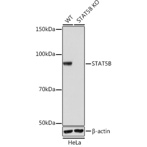 [KO Validated] STAT5B Rabbit mAb