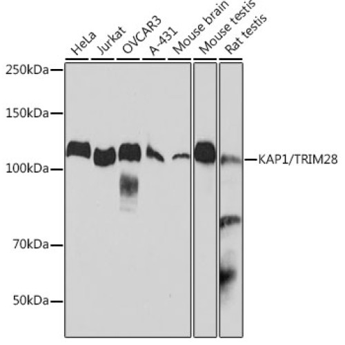 KAP1/TRIM28 Rabbit mAb