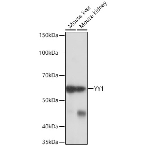 YY1 Rabbit mAb