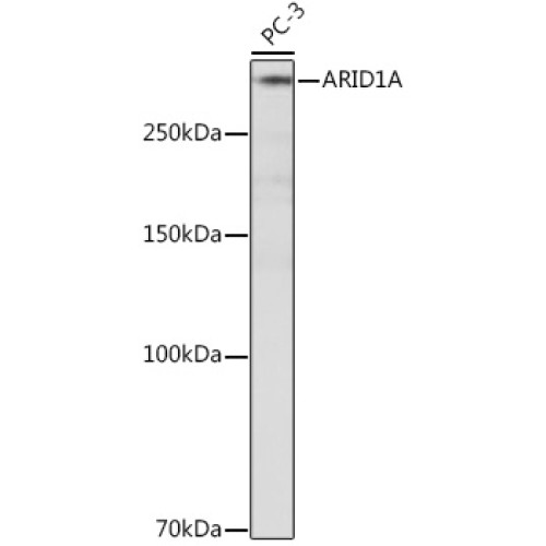 ARID1A Rabbit mAb