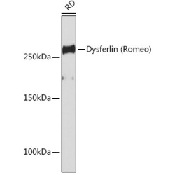 Dysferlin Rabbit mAb