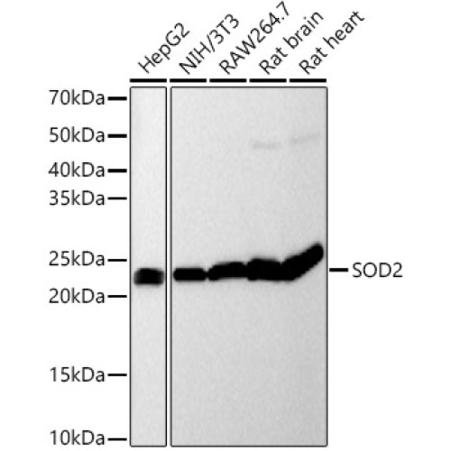 [KO Validated] SOD2 Rabbit mAb