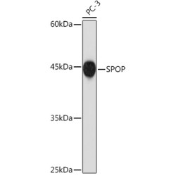 SPOP Rabbit mAb