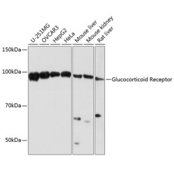Glucocorticoid Receptor Rabbit mAb