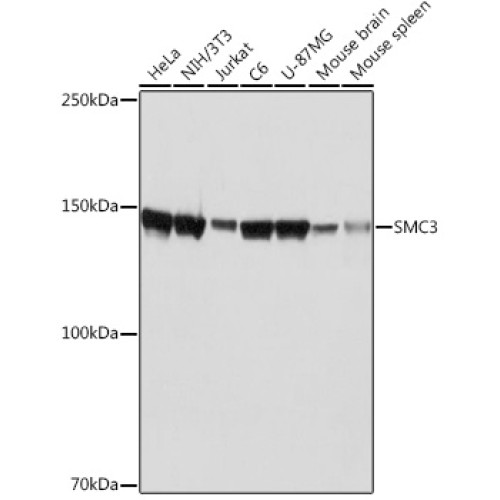 SMC3 Rabbit mAb