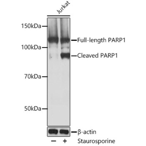PARP1 Rabbit mAb