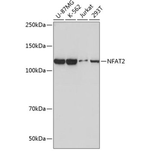 NFAT2 Rabbit mAb