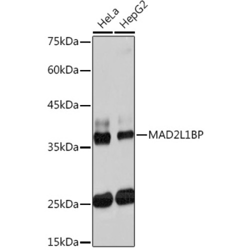 MAD2L1BP Rabbit mAb