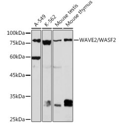 WAVE2/WASF2 Rabbit mAb