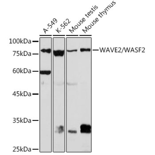 WAVE2/WASF2 Rabbit mAb