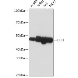 ETS1 Rabbit mAb