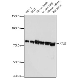 [KD Validated] ATG7 Rabbit mAb