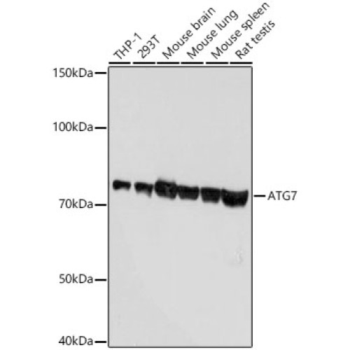 [KD Validated] ATG7 Rabbit mAb