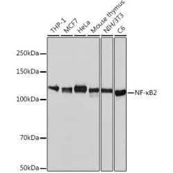 NF-κB2 Rabbit mAb