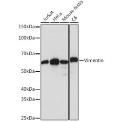 [KD Validated] Vimentin Rabbit mAb