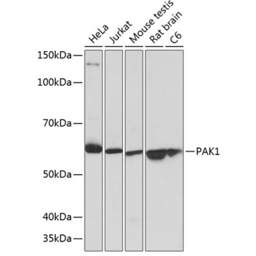 PAK1 Rabbit mAb