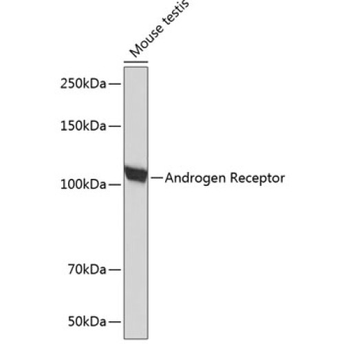 Androgen Receptor Rabbit mAb