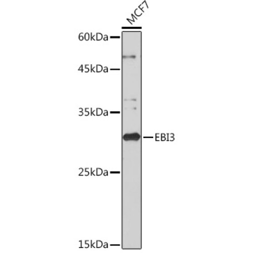 EBI3 Rabbit mAb