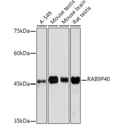 RAB9P40 Rabbit mAb