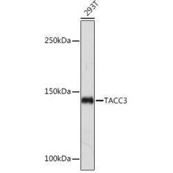 TACC3 Rabbit mAb