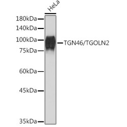 TGN46/TGOLN2 Rabbit mAb