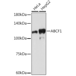 ABCF1 Rabbit mAb