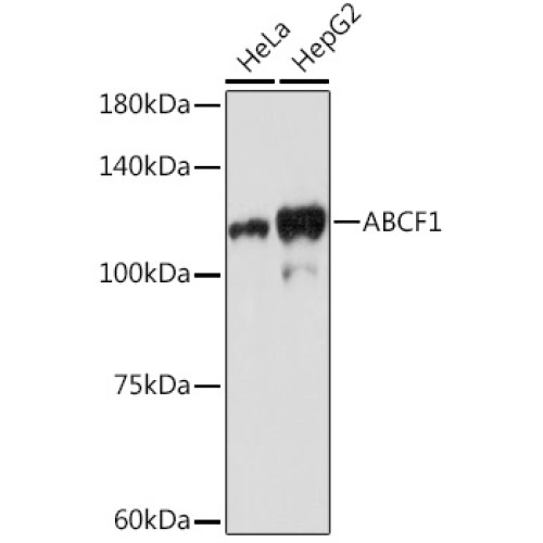 ABCF1 Rabbit mAb