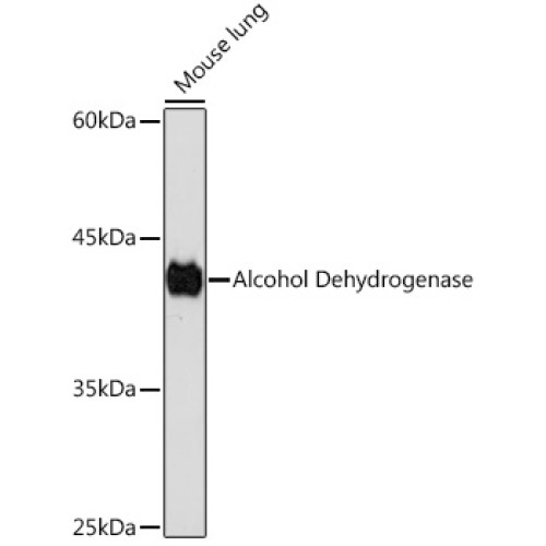 Alcohol Dehydrogenase Rabbit mAb