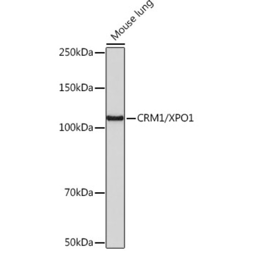 CRM1/XPO1 Rabbit mAb