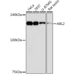 ABL2 Rabbit mAb