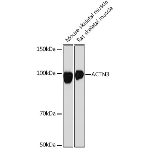 ACTN3 Rabbit mAb
