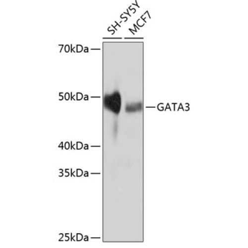 GATA3 Rabbit mAb