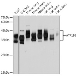 ATP1B3 Rabbit mAb