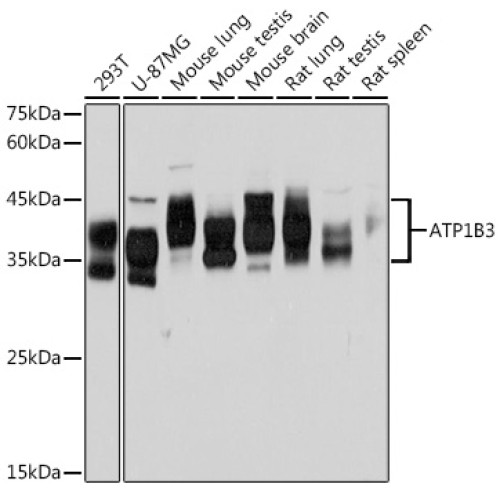 ATP1B3 Rabbit mAb