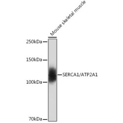 SERCA1/ATP2A1 Rabbit mAb