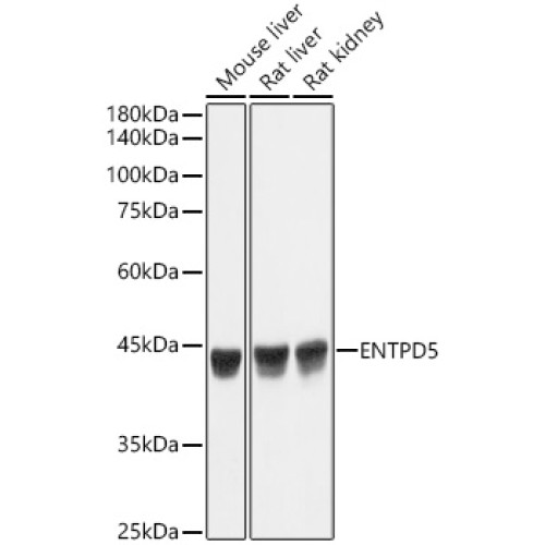 ENTPD5 Rabbit mAb