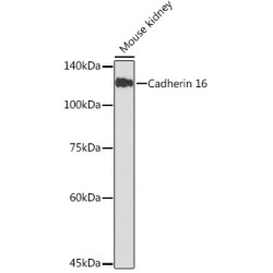 Cadherin 16 Rabbit mAb