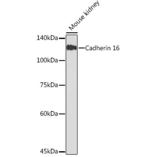 Cadherin 16 Rabbit mAb