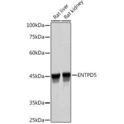 ENTPD5 Rabbit mAb