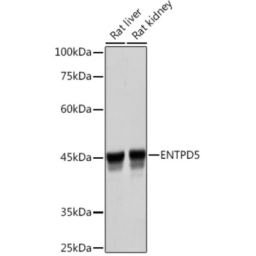 ENTPD5 Rabbit mAb